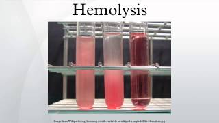 Hemolysis [upl. by Ibson463]