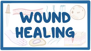 Wound healing [upl. by Uliram881]