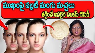 How to Remove Dark Spots Home Remedy for Pigmentation Face Pack  Dr K LalithaReddy iDreamDoctor [upl. by Berthold]