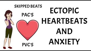 Ectopic heartbeats and anxiety Are they dangerous [upl. by Fishbein]