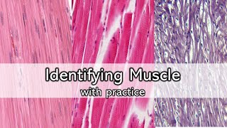 Identifying Muscle  Review and Practice [upl. by Etnasa]