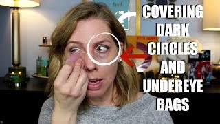 COVERING DARK CIRCLES AND UNDEREYE BAGS [upl. by Enohpets32]