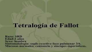 Tetralogía de Fallot [upl. by Sigmund594]