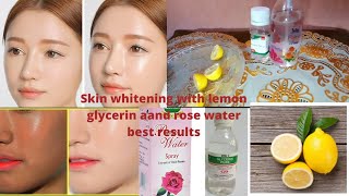 glycerine and rose water for skin whitening  glycerin for skin whitening su beauty and remedies [upl. by Kristel]