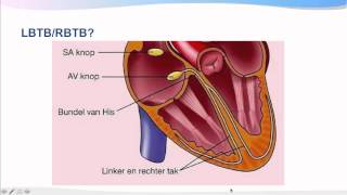 Introductiecursus ECG interpretatie [upl. by Vasta]