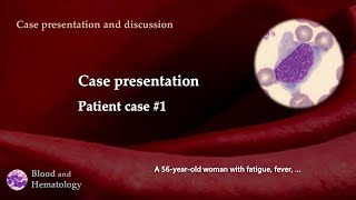 Patient case presentation case 1 [upl. by Aniger]