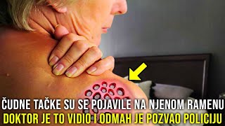 ČUDNE OKRUGLE TAČKE SE IZNENADA POJAVILE NA NJENOM RAMENU DOKTOR TO VIDIO I ODMAH POZVAO POLICIJU [upl. by Halonna]