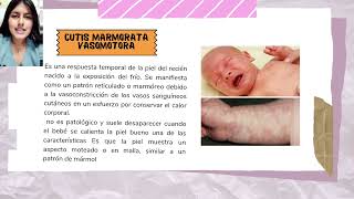 Neonatología y lactancia materna  Hallazgos normales y Anormales en la piel de un recién nacido [upl. by Kutchins343]