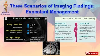 Three Scenarios of Imaging Findings Expectant Management [upl. by Fruin531]