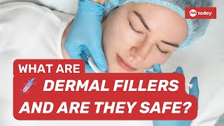 Explainer What are dermal fillers and how safe are they [upl. by Jehanna]