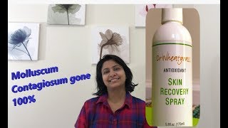 HOW TO TREAT MOLLUSCUM CONTAGIOSUM TRY Dr Wheatgrass skin recovery spray works 100 [upl. by Layol]