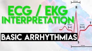 Basic Arrhythmias  Sinus Brady Tachy Premature Beats  ECG EKG Interpretation Part 3 [upl. by Nnaear163]