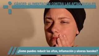 Cáncer Alimentación contra las aftas bucales [upl. by Lanor326]