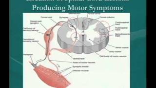 Clinical Significance of Demyelinating Lesions of the Central Nervous System [upl. by Eneluqcaj649]