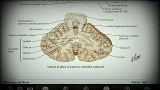 Анатомия с АВ Ромбовидный мозг rhombencephalon [upl. by Atilrak]