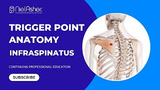 Exploring the Infraspinatus Understanding Trigger Point Locations for Better Muscle Health [upl. by Kriste]