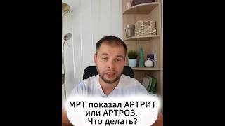 Восстановление суставов с помощью натуральных продуктов здоровыесуставы [upl. by Atrebla]