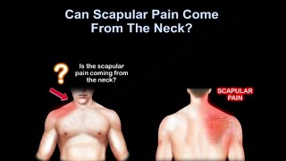 Neck pain or shoulder pain WHY IT HURTS [upl. by Eatnuahc314]