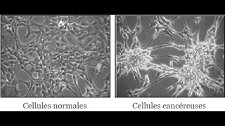 cellule normale vs cancéreuse [upl. by Starkey407]