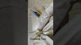 Oxidase test [upl. by Auqinal]