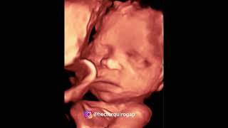 4D ultrasound at 27 weeks of pregnancy [upl. by Merchant]