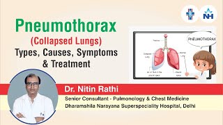 Pneumothorax  Types Causes Symptoms and Treatment  Dr Nitin Rathi [upl. by Nosneh]