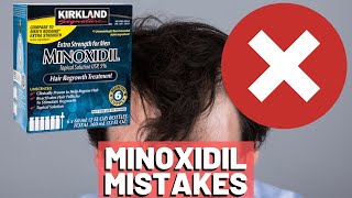 5 BIGGEST MISTAKES When Using Minoxidil REVEALED [upl. by Gunner315]