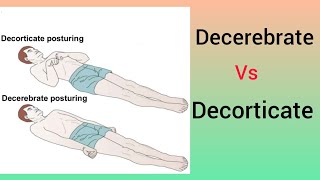 Nursing officers Decerebrate vs Decorticate [upl. by Aititel]