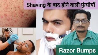 Shaving के बाद होने वाली फुंसीयाँ  Razor Bumps Treatment  Pseudofolliculitis Barbae razorbumps [upl. by Evod]