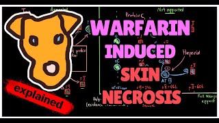 Pathogenesis of Warfarininduced skin necrosis Transient Hypercoagulation [upl. by Anurb]