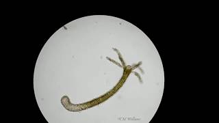 Hydra under compound microscope [upl. by Marji]