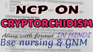 Nursing care plan on CRYPTORCHIDISM child health nursingmedical surgical nursingGNMBSC [upl. by Ecyt]