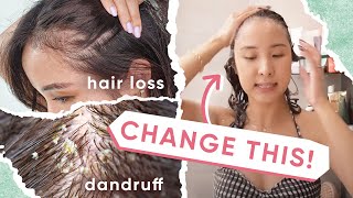 4 Reasons WHY Your Hair Loss amp Dandruff ISN’T Getting BETTER  5 TIPS [upl. by Paul256]