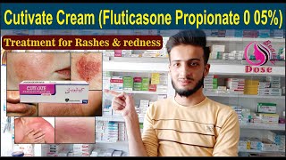 Cutivate Cream Fluticasone Propionate 0 05  Uses Side Effects Application  O Beauty Dose [upl. by Ursala68]