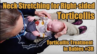 3R Neck Stretching for Rightsided Torticollis Torticollis Treatment in Babies [upl. by Romonda657]