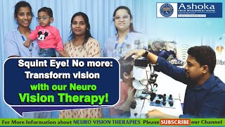 Get Cure of Your Squint Eyes with Neuro Vision Therapy  Best Neuro Vision Therapy Centre in Hyd [upl. by Ahsinrats]