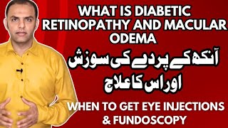 Diabetic Retinopathy And Macular Odema Treatment drfaisalanwar eyedoctor [upl. by Nairadal]