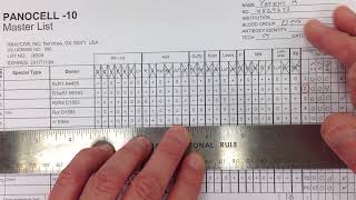 Blood Bank  Antibody Identification I [upl. by Assenahs]