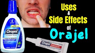 Ive used this mouth sore gel since I had a braces ORAJEL Full Review orajel [upl. by Luckin]