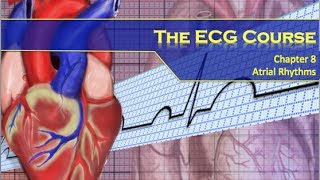 The ECG Course  Atrial Rhythms [upl. by Adlemy]