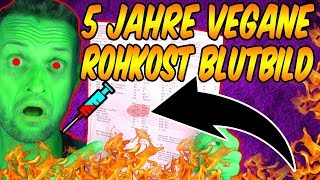 Wieso mein BLUTBILD unschlagbar scheint  Vegan Rohkost Vitamin D [upl. by Terence580]