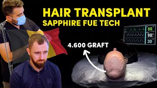 Hair Transplant Turkey  Patient Experience [upl. by Perry583]