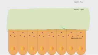 H Pylori and Ulcers [upl. by Asenab]