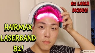 HAIRMAX LASERBAND 82 REVIEW FOR HAIR LOSS TREATMENT [upl. by Dnomse]