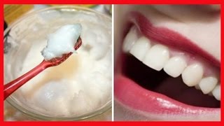 Pasta de Dente Caseira que Elimina CARIES e Clareia os Dentes em 3 Minutos [upl. by Converse]