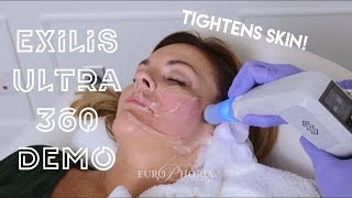 EXILIS ULTRA DEMONSTRATION FACE  Exilis Ultra 360 Experience at EuroPhoria [upl. by Inattyrb810]