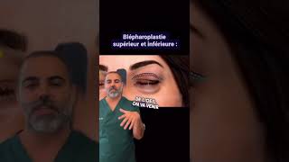 Voilà comment se passe une blépharoplastie supérieure et inférieure  ✨ [upl. by Ghassan]