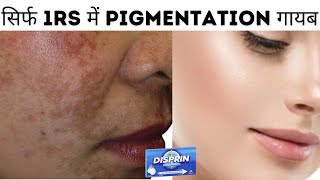 Disprin Tablets For Skin Freshness and Antiacne  How To Use Disprin  1Rs में pigmentation गायब [upl. by Eiramanna]