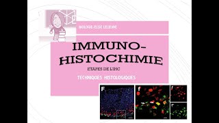 Immunohistochimie Etapes du protocole [upl. by Enylodnewg]