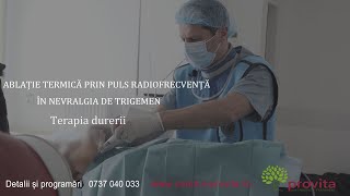 Ablatia termica prin puls radiofrecventa in nevralgia de trigemen [upl. by Yarak]